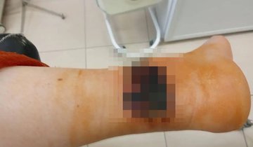 z0J8JrgZ_SwoN_GMhTpK2Gek_GGEe36S4vKZHBoQRL3GezsAOVL5ICu0jpyKBi4jDpshj3RyaaoLCB8cDgdzq3Vs